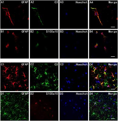 Effects of FGF2/FGFR1 Pathway on Expression of A1 Astrocytes After Infrasound Exposure